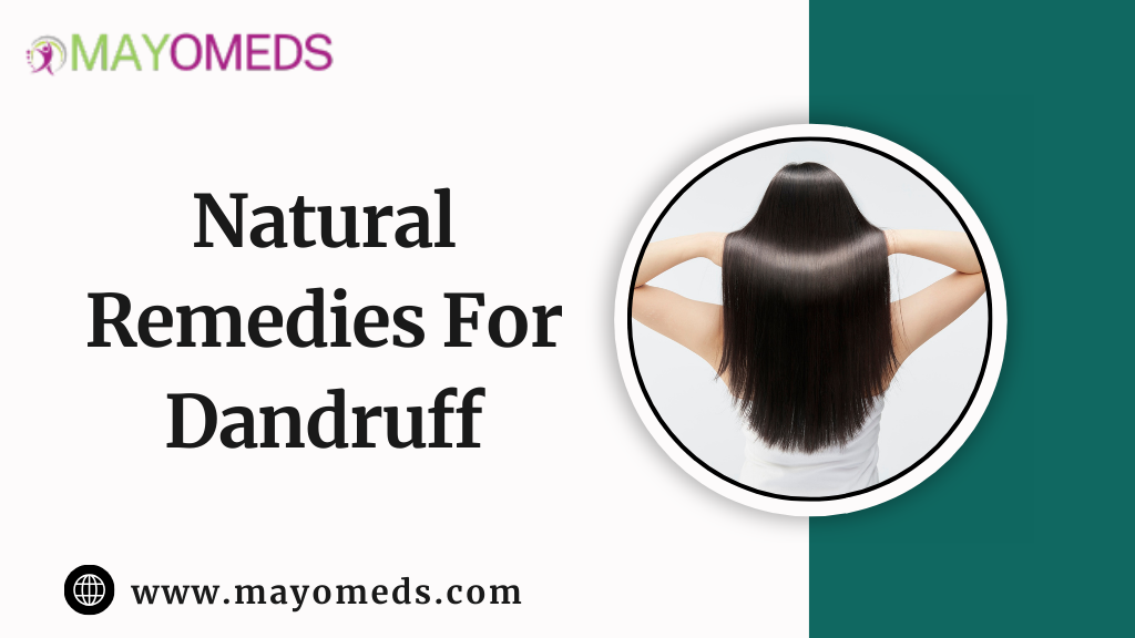 Natural Remedies For Dandruff